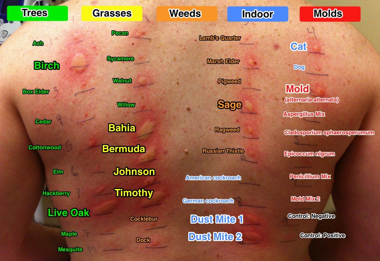 19+ Cat Allergy Test Results ~ The Ideas