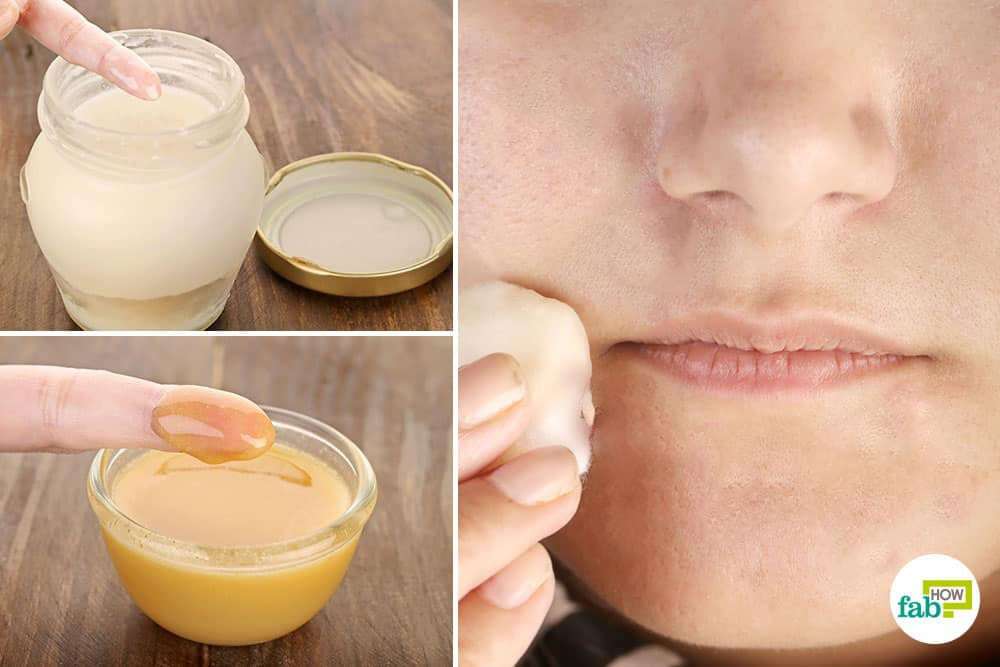 How to Get Rid of Perioral Dermatitis: Heal Rashes with 9 ...