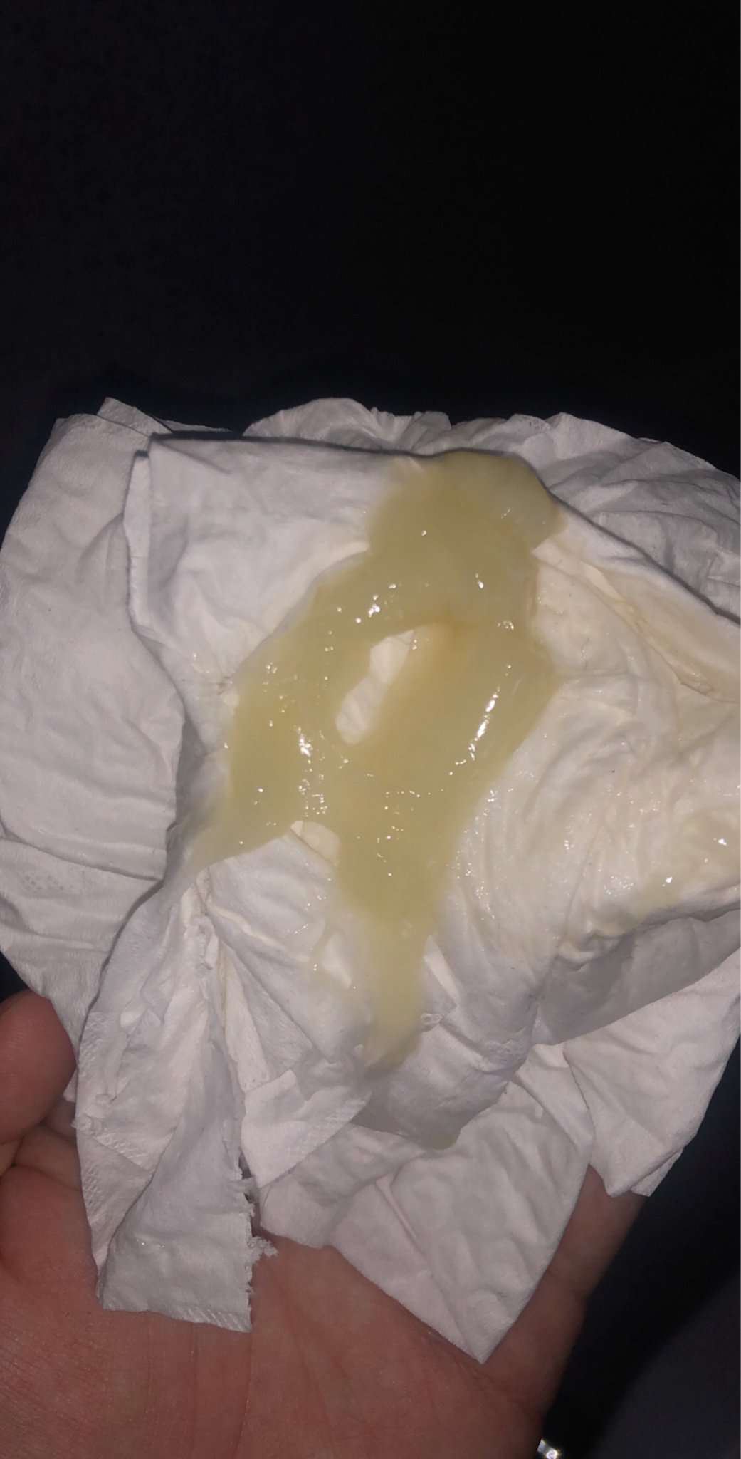 Is this my mucus plug?
