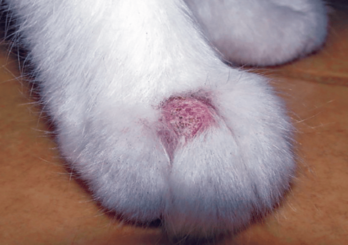Ringworm Causes Dry, Itchy Skin