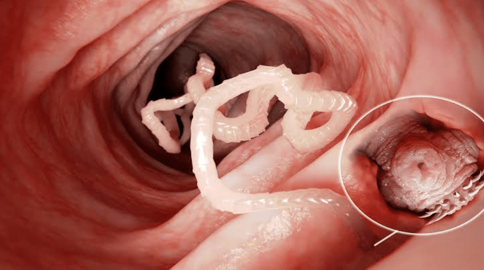 Tapeworm Infestation: How To Get Rid Of It