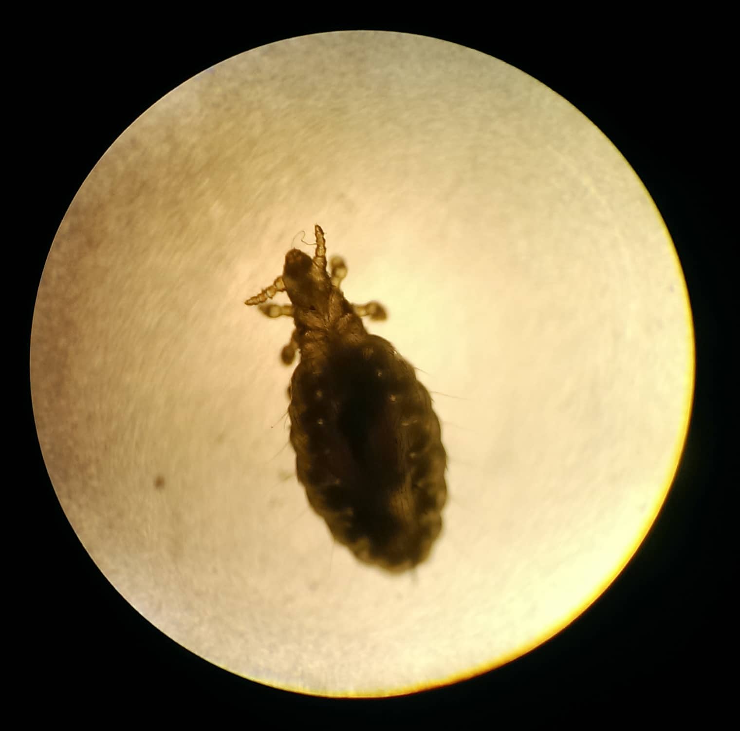 The Most Common Ectoparasites in Montana